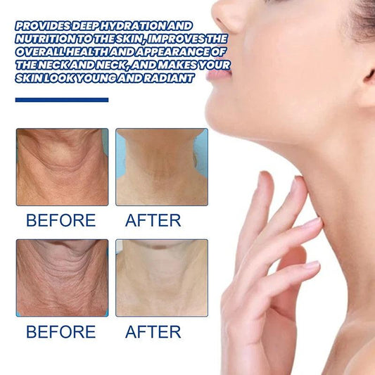 Collagen Neck Cream Anti-aging Tightening Lifting Whitening Moisturizing For Neck Double Chin Reduce - SajiDeals