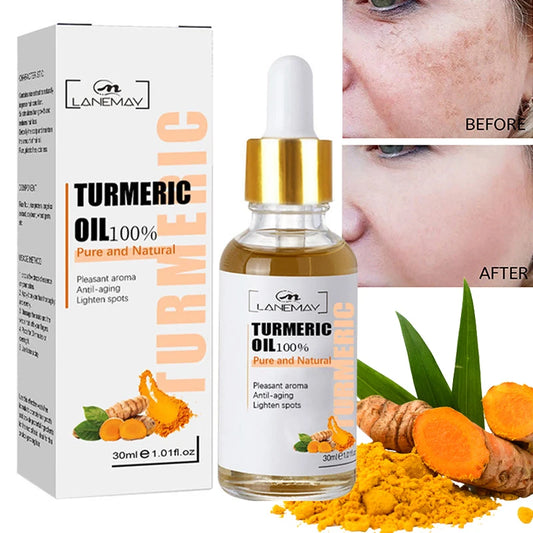 Turmeric Freckle Whitening Serum Fade Dark Spots Removal Pigment Melanin Correcting Facial Beauty Face Skin Care Products 30ml - SajiDeals