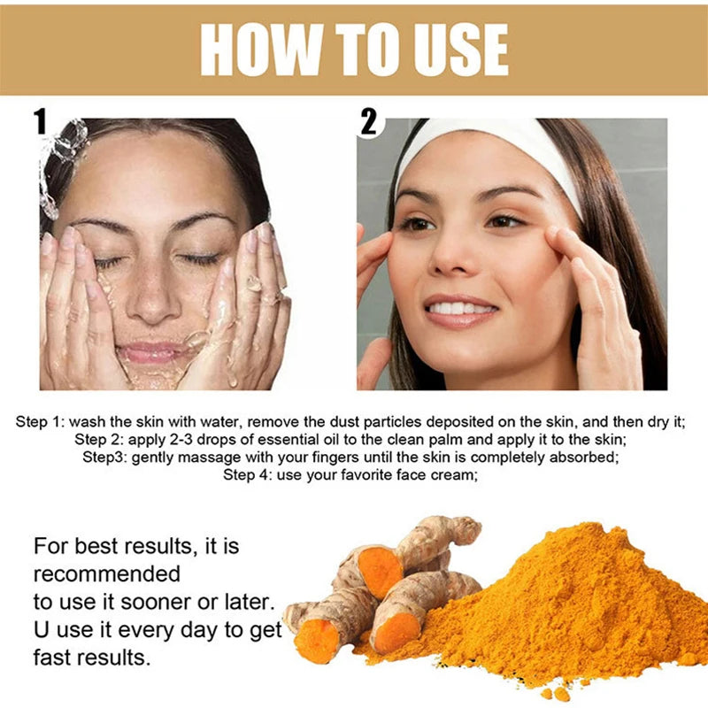 Turmeric Freckle Whitening Serum Fade Dark Spots Removal Pigment Melanin Correcting Facial Beauty Face Skin Care Products 30ml - SajiDeals